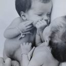 Похожие в детстве, сейчас разные: Стало известно, как живут разделенные гениальным хирургом сиамские близнецы